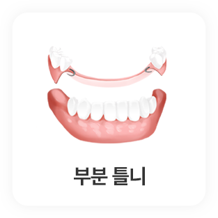 부분 틀니