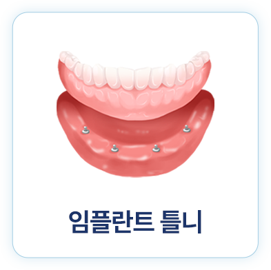 임플란트 틀니